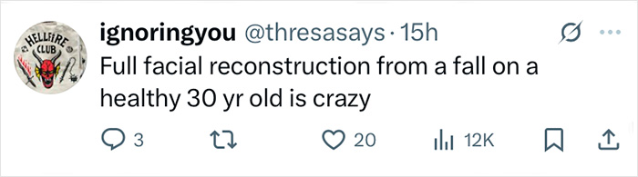 Tweet from ignoringyou commenting on Zac Efron's back to normal face after facial reconstruction at age 30.