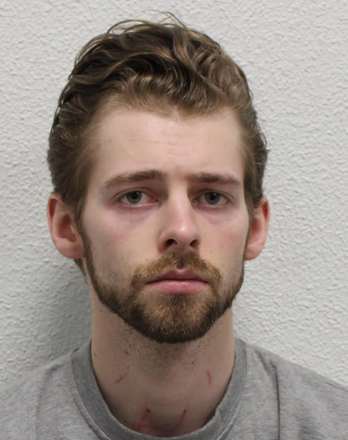 Young US student with a serious expression, showing marks on his neck after altercation with girlfriend, against plain wall background