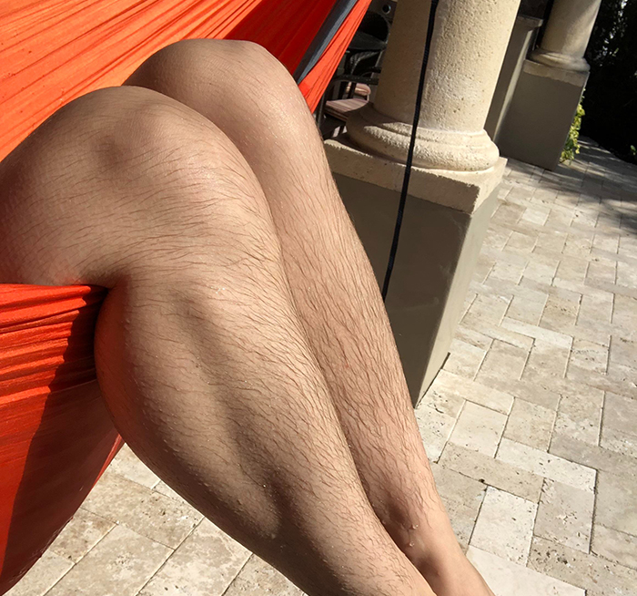 Close-up of hairy legs resting in an orange hammock, illustrating body hair related to laser hair removal debate.