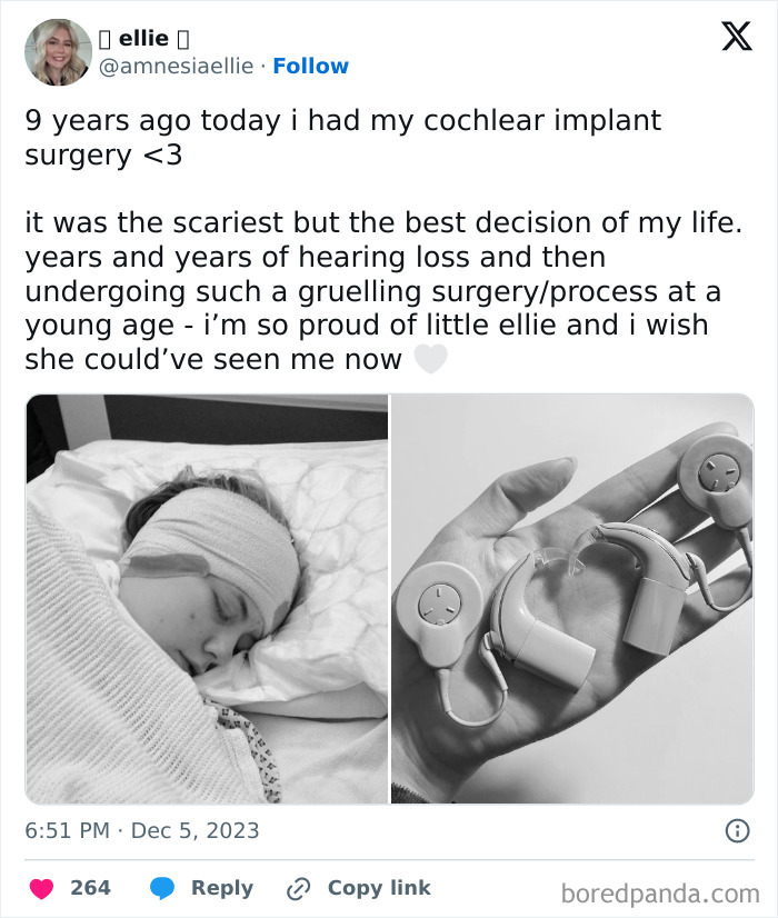 Person sharing a leap of faith story about cochlear implant surgery as a life-changing decision for better hearing.