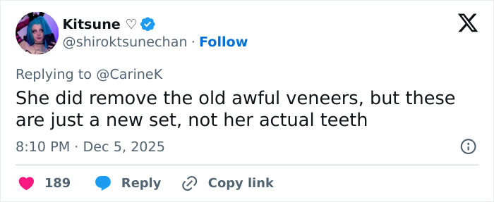 Tweet discussing Miley Cyrus&rsquo;s youthful glow and viral makeover after removing old veneers and getting a new set of teeth.
