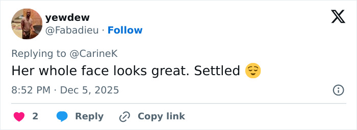 Miley Cyrus&rsquo;s youthful glow and viral makeover spark frenzy after she took the veeners out in a fresh new look.