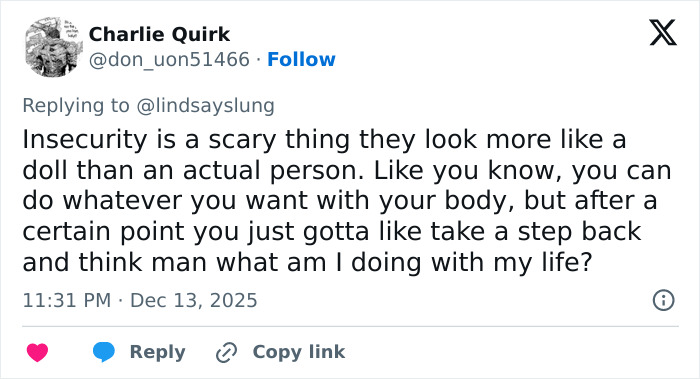 "She Was Not Well": Mary Magdalene, 33, Influencer Known For Extreme Cosmetic Surgeries, Passes Away After High‑Rise Fall