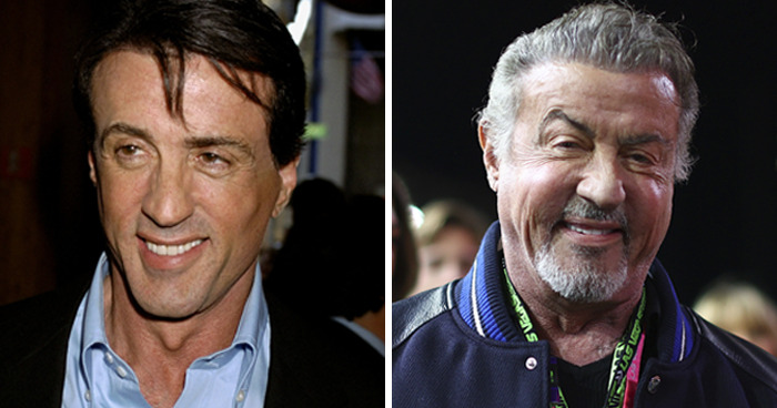 Side-by-side photos of an actor before and after plastic surgery showing changes in appearance and aging.