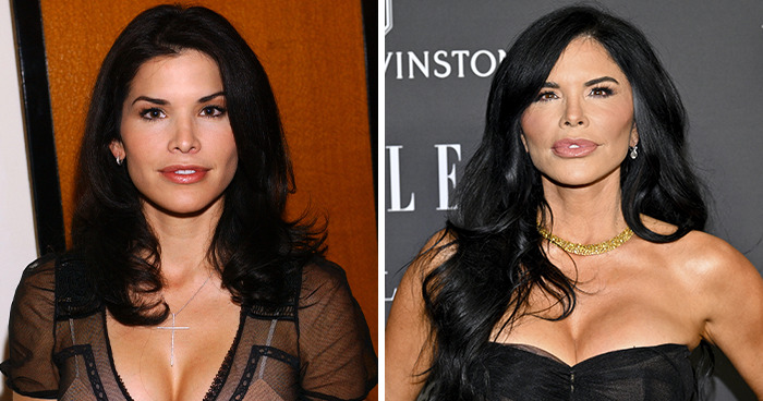 Side-by-side images of a female celebrity before and after plastic surgery, highlighting changes in facial features.