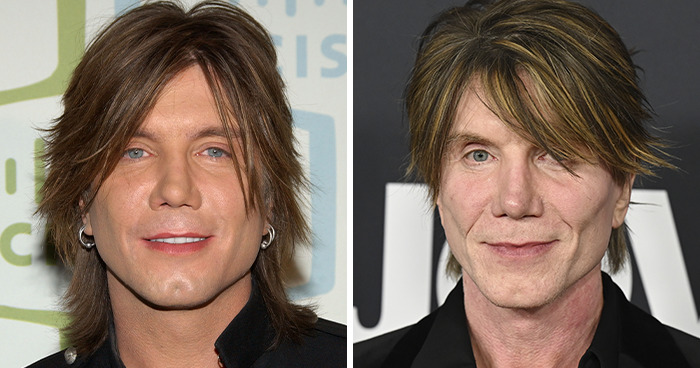 Side-by-side close-up photos of a male celebrity showing before and after effects related to plastic surgery experiences.