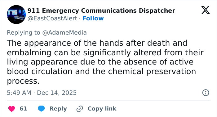Tweet discussing the altered appearance of hands after death and embalming, explaining changes in circulation and preservation effects.