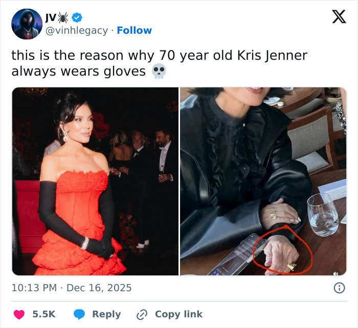 Kris Jenner ditches gloves in public revealing hands after viral $100k facelift discussions with close-up on aged hands.