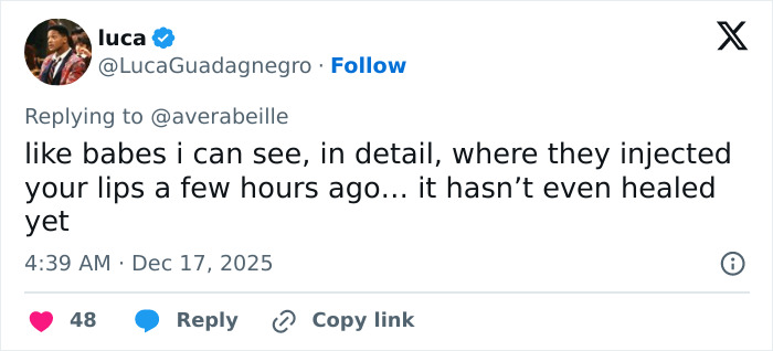 Social media post defending Karoline Leavitt&rsquo;s close-up photo amid lip filler mark mockery discussions.