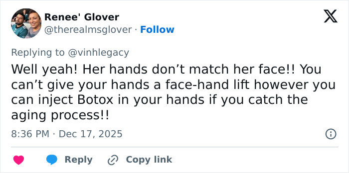 Twitter reply discussing hands aging and Botox, mentioning the viral $100k facelift and hands never lie keyword.