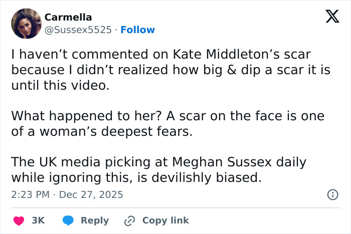 Tweet discussing Kate Middleton&rsquo;s scar and conspiracy theories during a Christmas appearance sparking wild rumors.