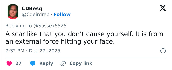 Tweet discussing Kate Middleton's scar and conspiracy theories about cancer during her Christmas appearance.