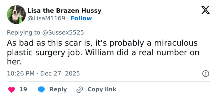 Tweet discussing Kate Middleton&rsquo;s scar, prompting wild conspiracy theories about her never having cancer.