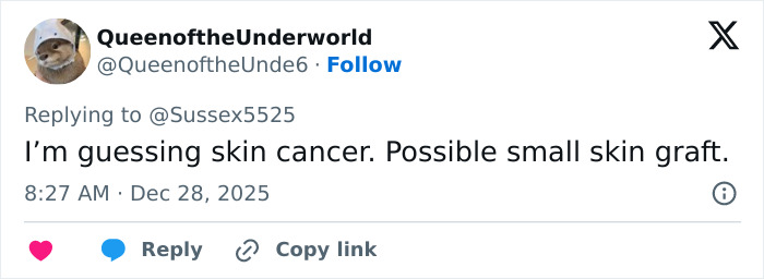 Tweet discussing a possible skin cancer scar and small skin graft in reference to Kate Middleton&rsquo;s appearance.