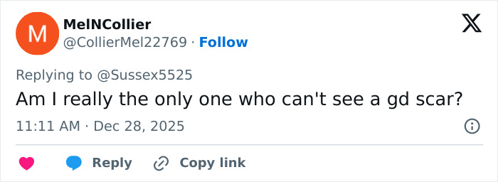 Tweet questioning visibility of Kate Middleton's scar during Christmas appearance sparking cancer conspiracy theories.