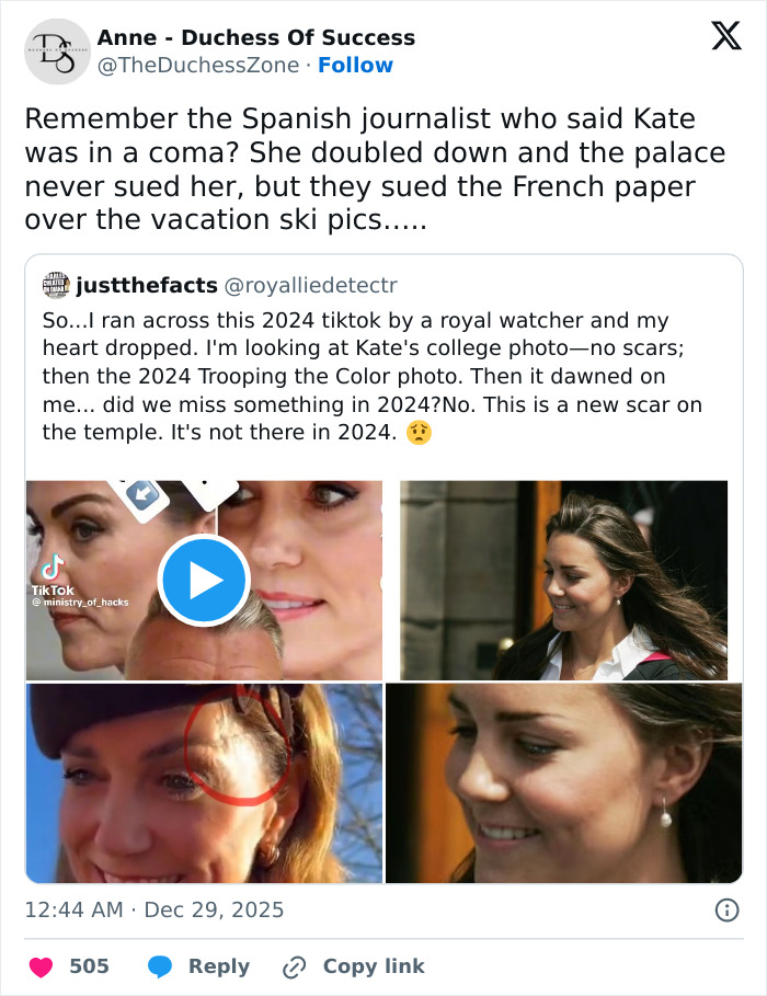 Kate Middleton's facial scar sparks rumors about the seriousness of her 2024 hospitalization and health concerns. Kate Middleton's facial scar sparks rumors about the seriousness of her 2024 hospitalization and health concerns.