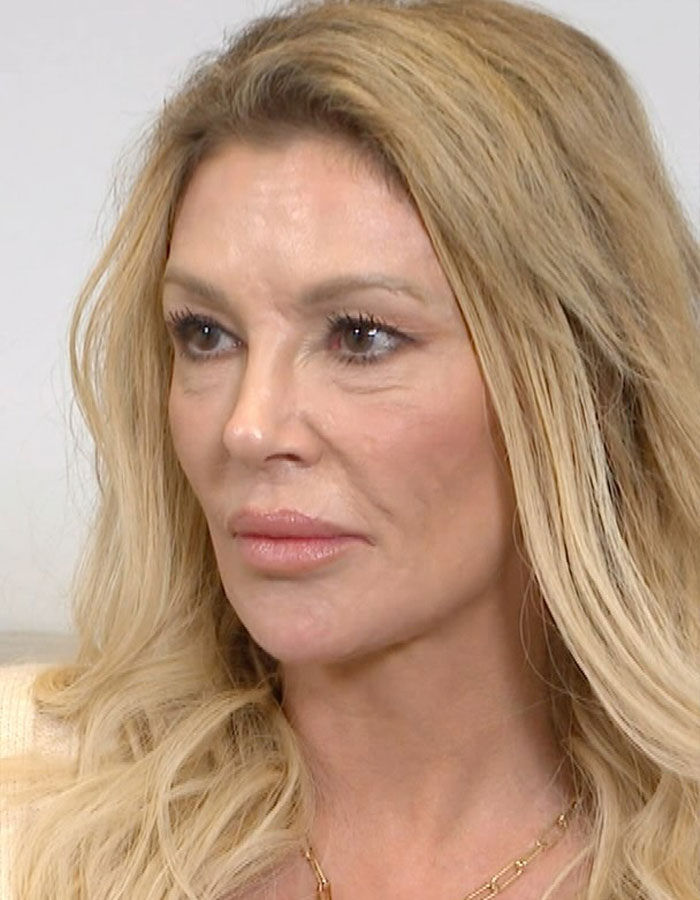 Close-up of Brandi Glanville looking serious, highlighting face disfigurement diagnosis after bold red bikini appearance.