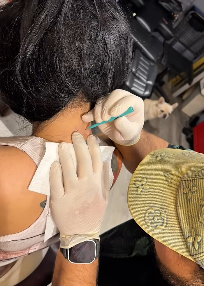 Person receiving neck piercing as part of new set of neck and back piercings with gloved hands performing the procedure.