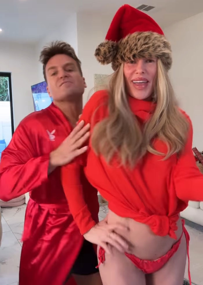 Brandi Glanville posing confidently in a red bikini and Santa hat after face disfigurement diagnosis and psychosis on display.