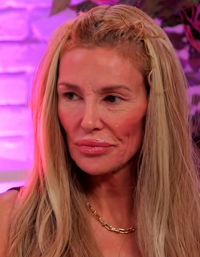 Brandi Glanville with long blonde hair and gold chain necklace after face disfigurement diagnosis in a bold look.