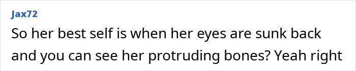 Comment criticizing Ariana Grande's appearance mentioning body-shaming and her eyes and protruding bones. Comment criticizing Ariana Grande's appearance mentioning body-shaming and her eyes and protruding bones.