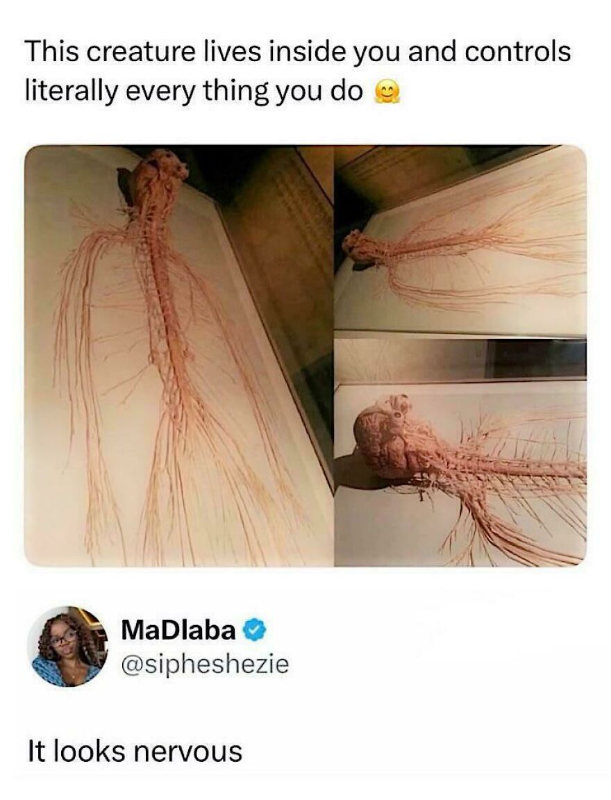 An image showing a nervous nervous system specimen with a humorous caption, from a joke rewarded with angry upvotes.