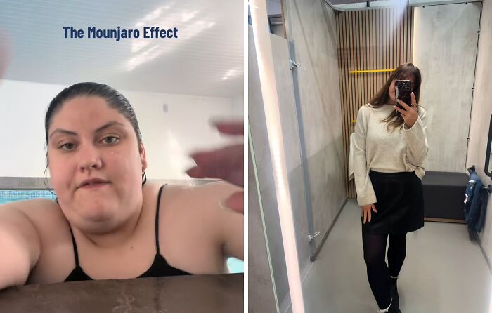 Before and after photos showing the Mounjaro effect on weight loss, with a side-by-side comparison of an individual’s transformation.