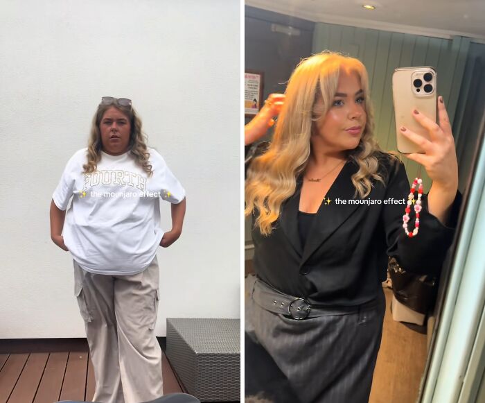 Before and after photos of a woman showcasing the Mounjaro effect in her inspiring weight loss journey.