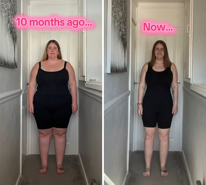 Side-by-side photos showing a woman’s weight loss transformation after using Mounjaro for 10 months.