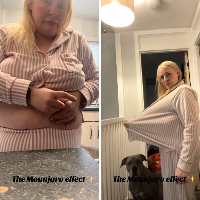 Before and after photos of a woman demonstrating the Mounjaro effect in her weight loss journey at home.