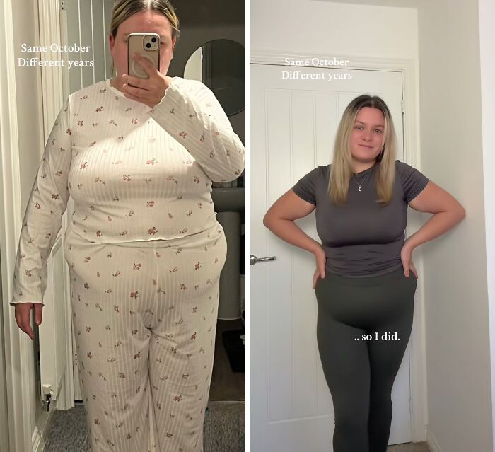 Before and after photos showing weight loss progress of a woman, illustrating the Mounjaro effect on body transformation.