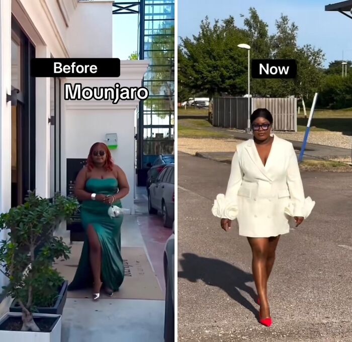 Side-by-side photo showing a woman's weight loss transformation with the Mounjaro effect before and after using the medication.