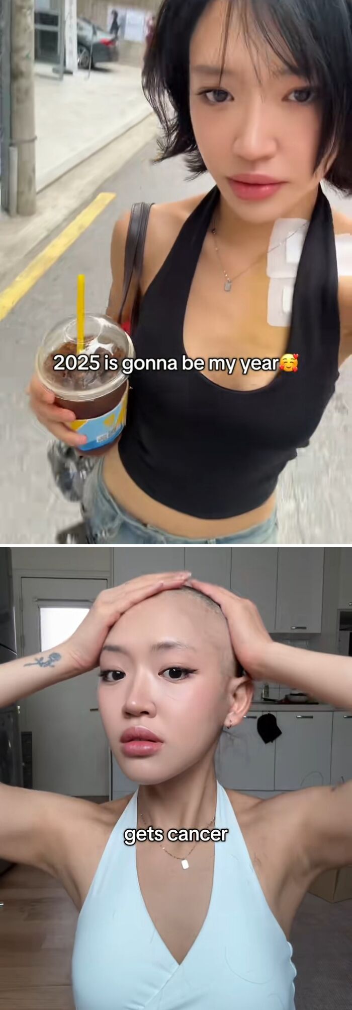 Young woman holding iced drink smiling optimistically then showing bald head after cancer diagnosis in 2025 year backfire.