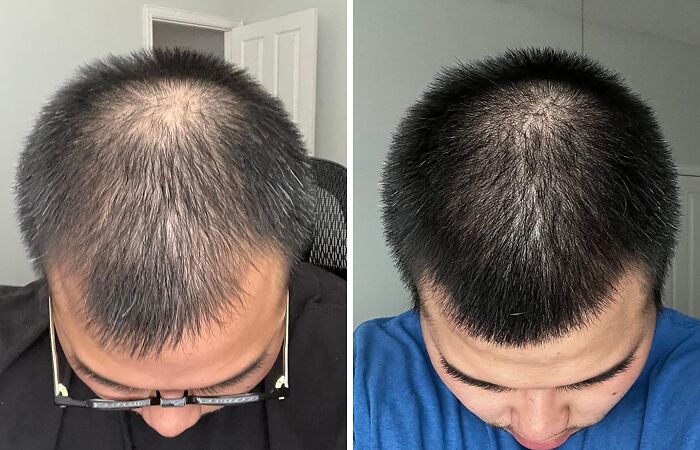  Convincing The World You Drink Enough Water And Eat Your Greens Is Surprisingly Simple When The Rosemary And Biotin Shampoo Gives You That Healthy Shine Despite Your Diet Of Iced Coffee And Takeout