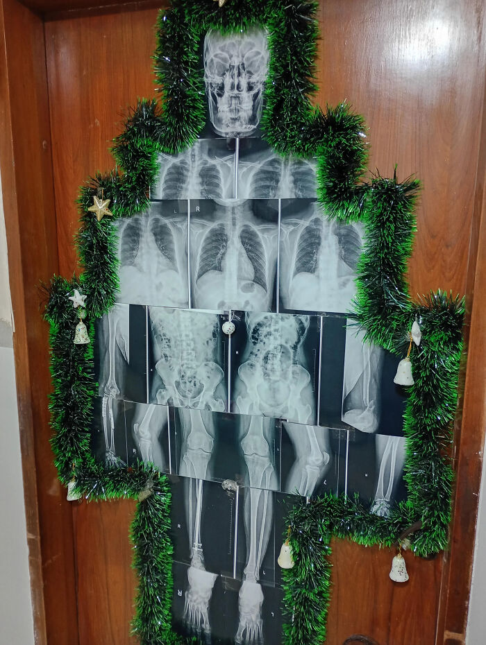 X-ray collage arranged like a Christmas tree on a door with green tinsel and ornaments, Funny Pictures From 2025