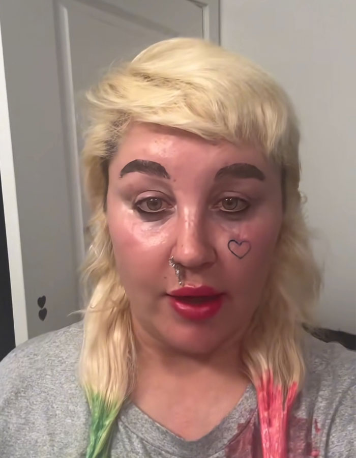 Amanda Bynes with colorful hair tips and face tattoo, discussing injections after dramatic weight loss Paparazzi pic revealed