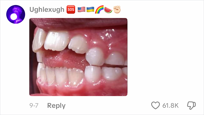 Close-up of crooked teeth in a viral homeschool clip prompting people to question parenting choices online.