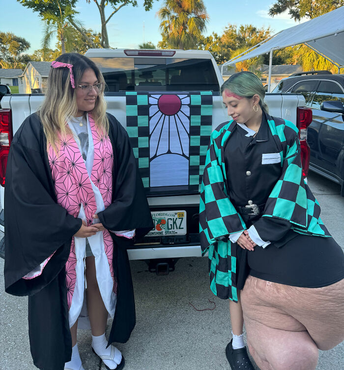 Two teenage girls wearing patterned robes stand beside a truck, one with a large leg affected by a rare condition.