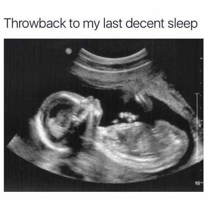 Ultrasound image with caption referencing goth memes about struggle and feeling like not fitting in.