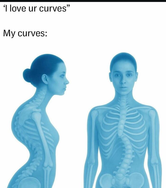 Humorous meme showing two blue-toned people with curved spines illustrating reality curves with humor.