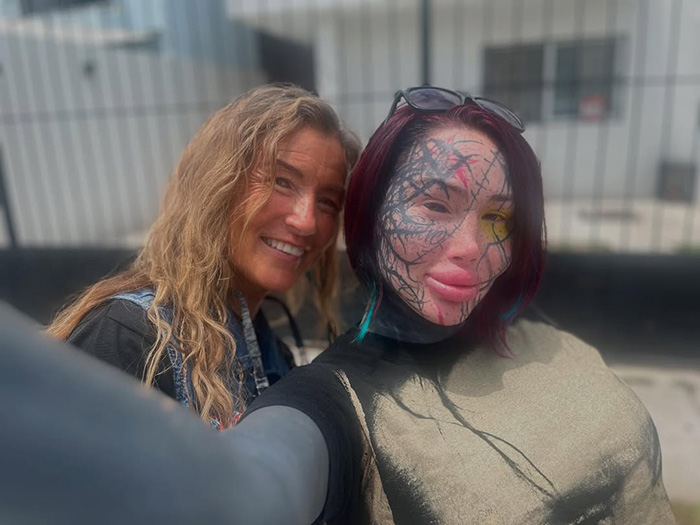 "She Was Not Well": Mary Magdalene, 33, Influencer Known For Extreme Cosmetic Surgeries, Passes Away After High‑Rise Fall