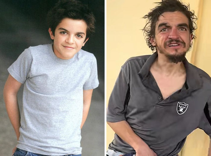 Nickelodeon star pictured in a before and after comparison highlighting his struggle with homelessness and hardship.