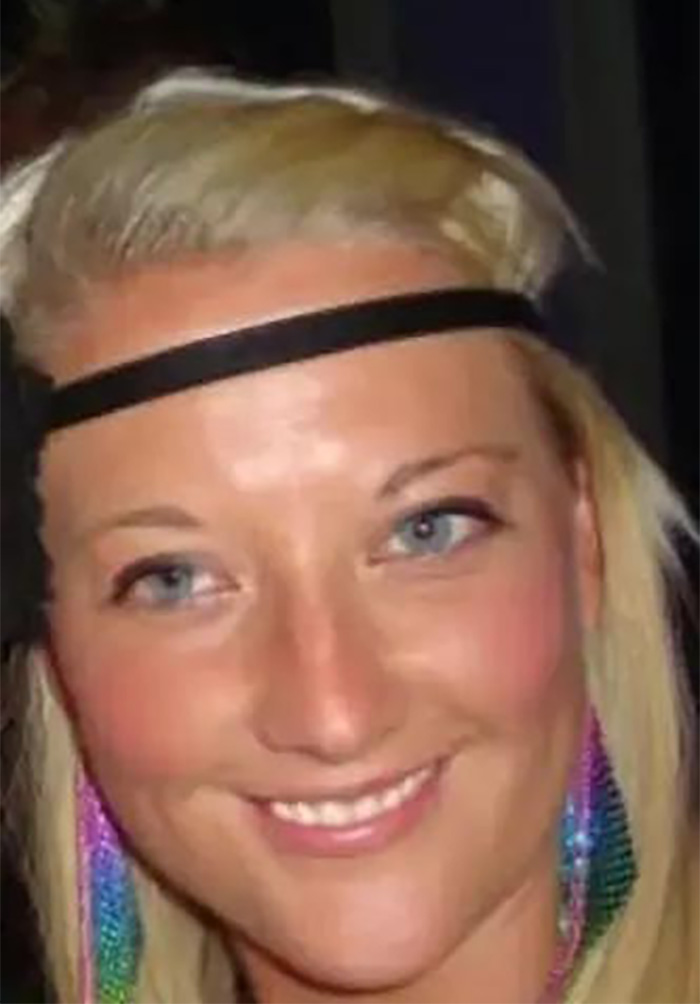 Smiling woman with blonde hair and colorful earrings, showcasing veneers, discussing nose collapsed after procedure in Turkey. Smiling woman with blonde hair and colorful earrings, showcasing veneers, discussing nose collapsed after procedure in Turkey.