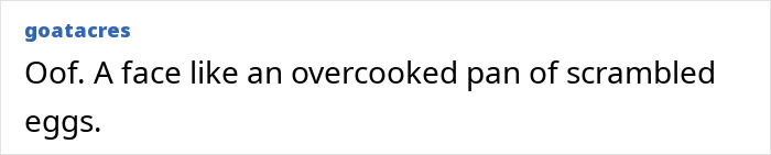 Brandi Glanville confidently posing in a bold red bikini after face disfigurement diagnosis, showing psychosis on display.