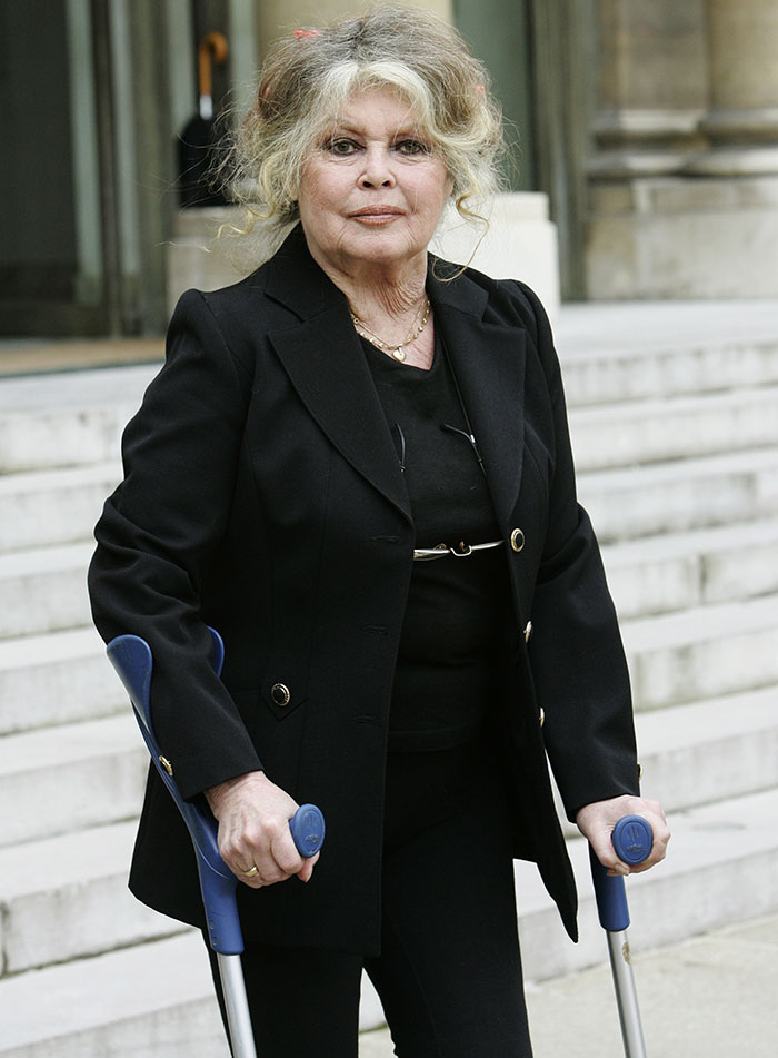 Brigitte Bardot wearing black outfit using crutches while standing on outdoor steps in daylight. Brigitte Bardot wearing black outfit using crutches while standing on outdoor steps in daylight.