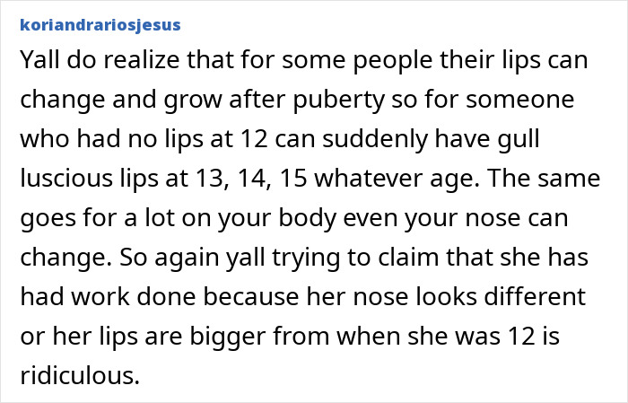 Fan comment discussing Sydney Sweeney's natural beauty claim and changes in lips and nose over time as evidence.