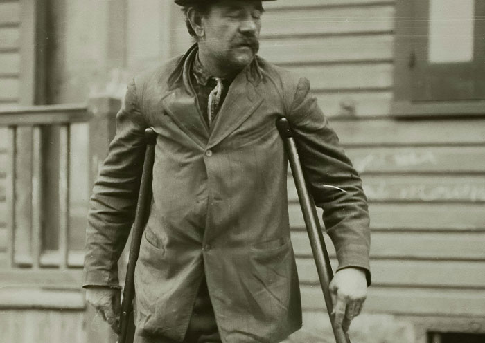 Man using crutches outdoors in historical black and white photo illustrating bizarre facts from history.