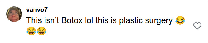 Comment on social media post saying this isn’t Botox but plastic surgery with laughing emojis, discussing plastic surgery rumors. Comment on social media post saying this isn’t Botox but plastic surgery with laughing emojis, discussing plastic surgery rumors.
