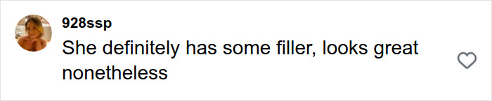 User comment on social media about plastic surgery rumors, mentioning filler and complimenting appearance. User comment on social media about plastic surgery rumors, mentioning filler and complimenting appearance.