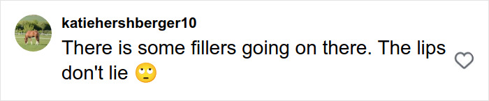 Screenshot of a social media comment discussing fillers and lip appearance related to plastic surgery rumors. Screenshot of a social media comment discussing fillers and lip appearance related to plastic surgery rumors.